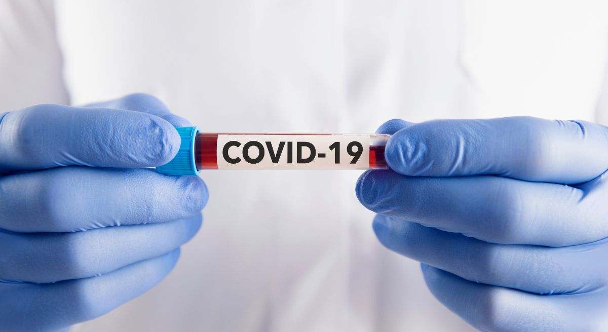 La COVID-19