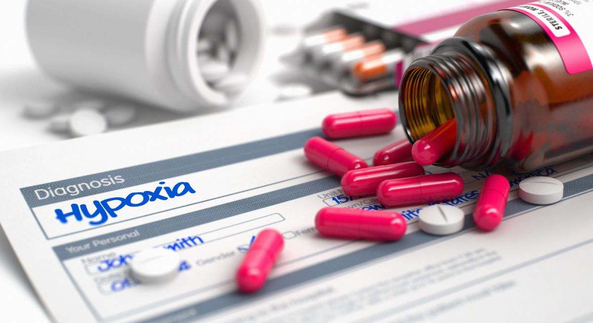 hipoxia-cerebral-dreamstime.jpg