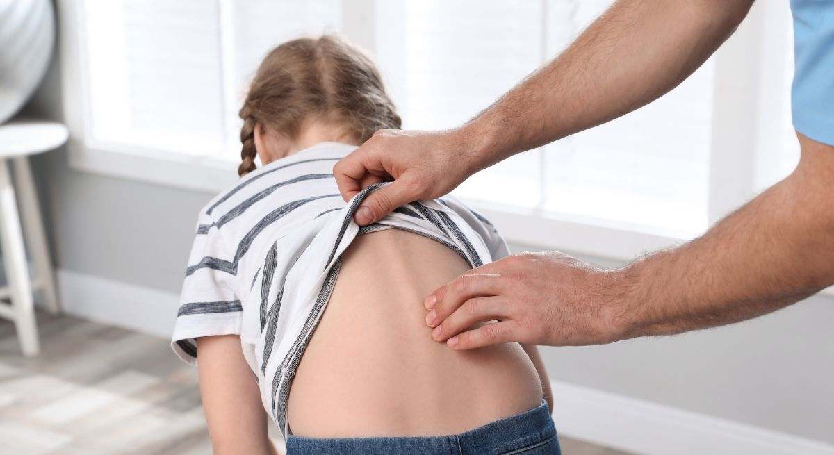 La escoliosis idiopática es aquella en la que no se puede establecer una causa