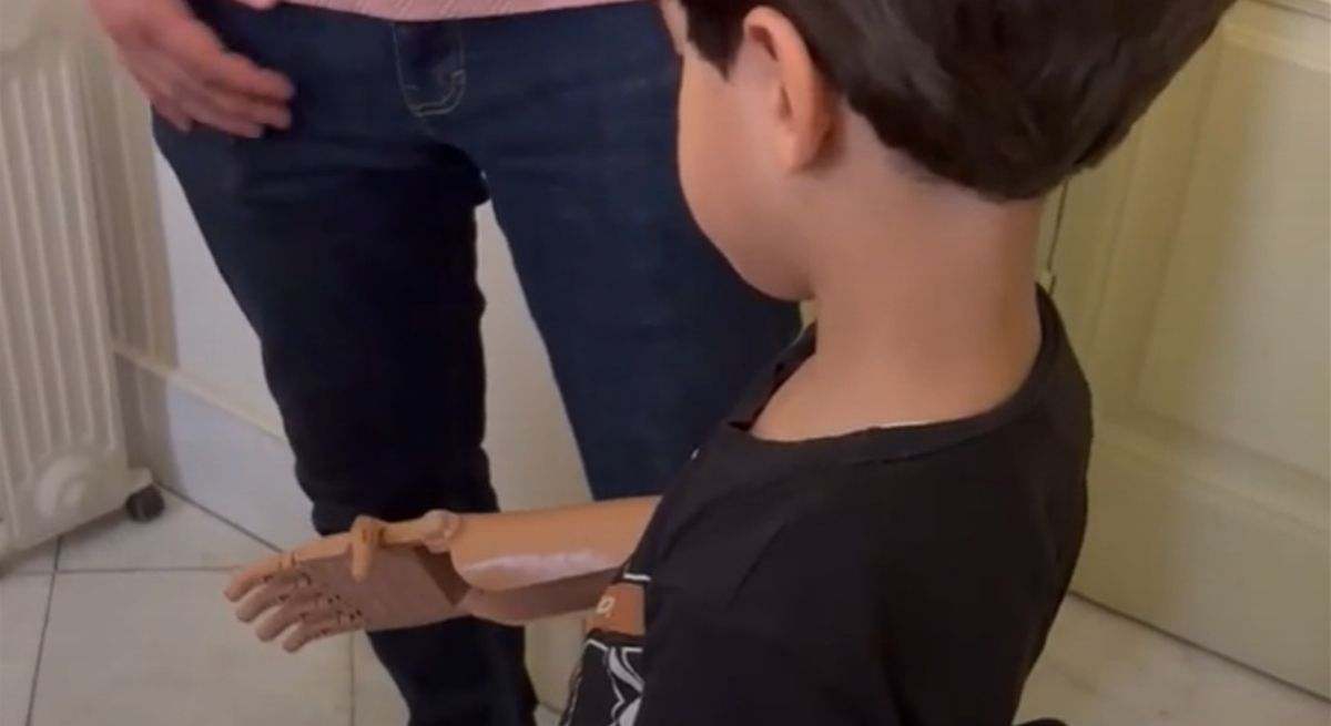 Ayúdame3D: la ONG española que diseña y entrega prótesis impresas en 3D para los niños amputados de Gaza
