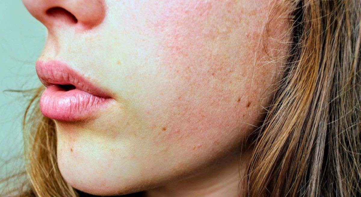Crema hidratante facial Hydra Rich Solution de Bella Aurora
