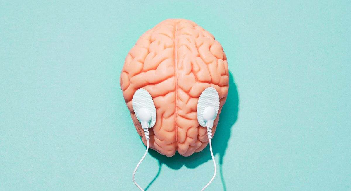 Cerebro con electro estimulación