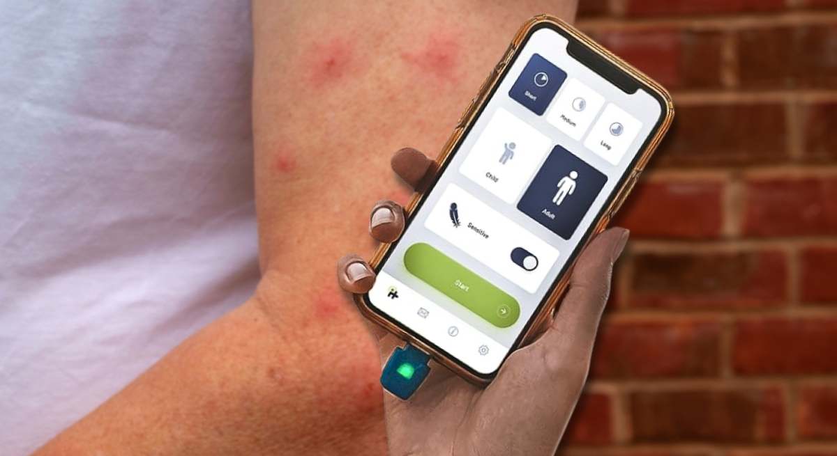 Adiós a hacerse daño rascando las picaduras de mosquito.