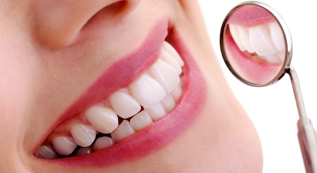 caries.jpg