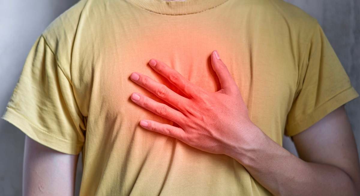 infarto-camva
