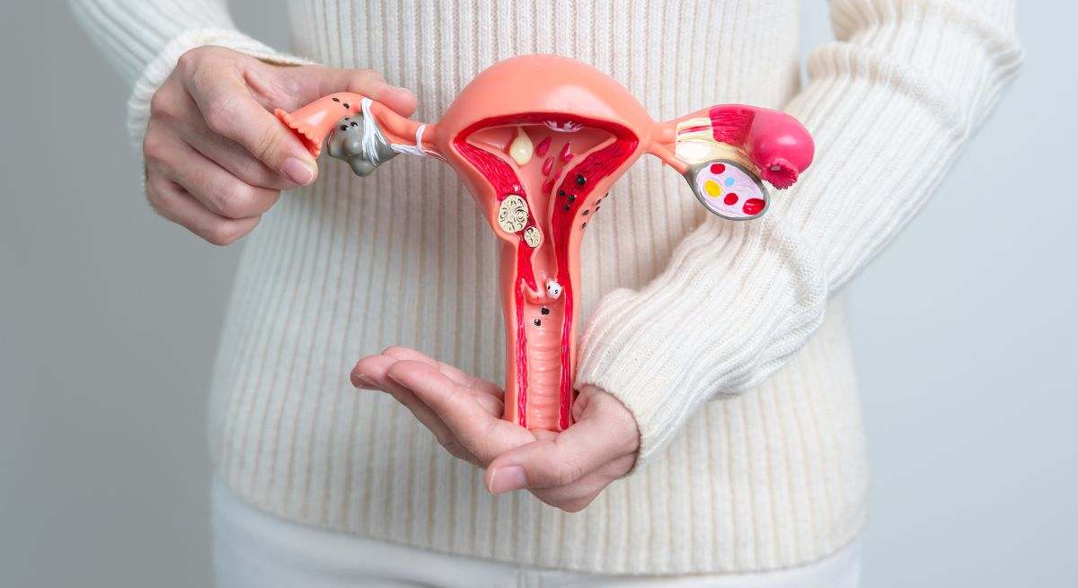 Cáncer de ovario