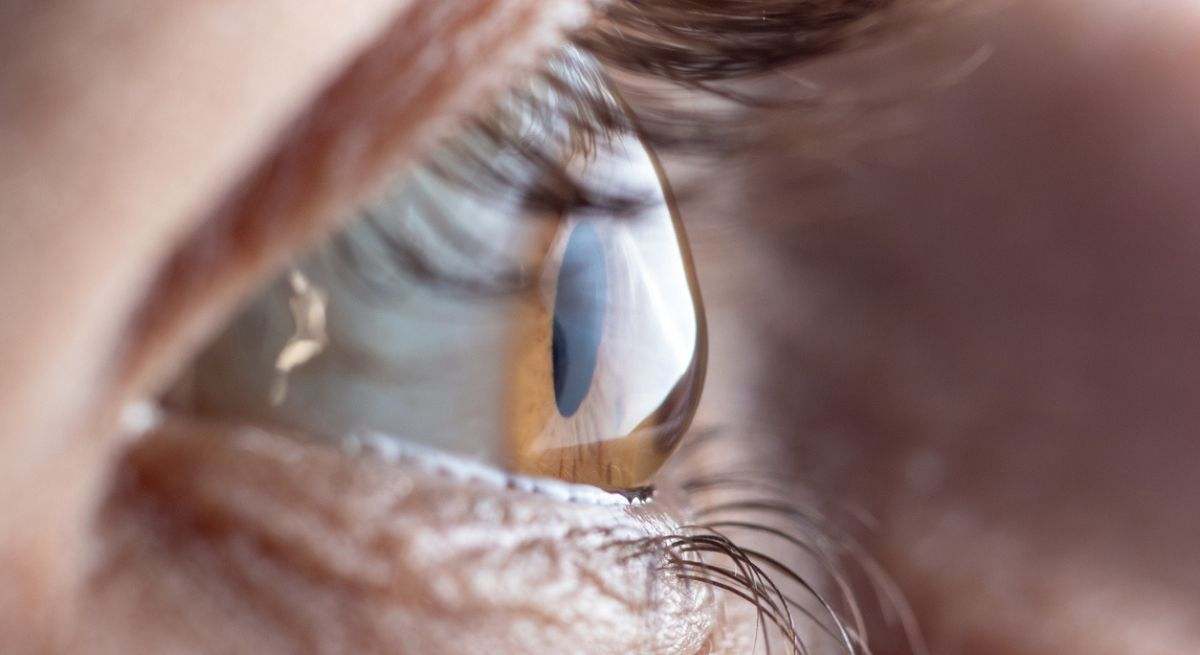 tratamiento-ceguera-istock.jpg