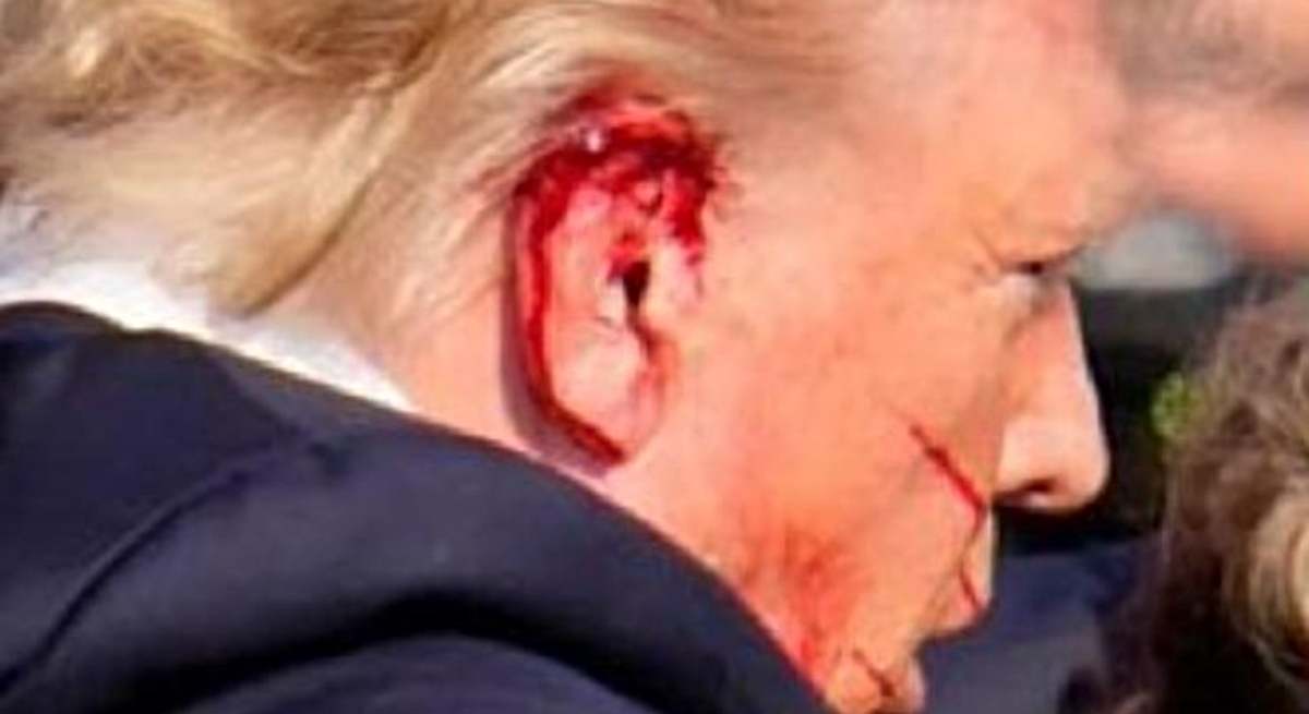 La oreja de Donald Trump ensangrentada