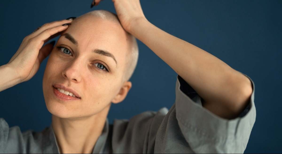 La alopecia femenina, tan desconocida como común.