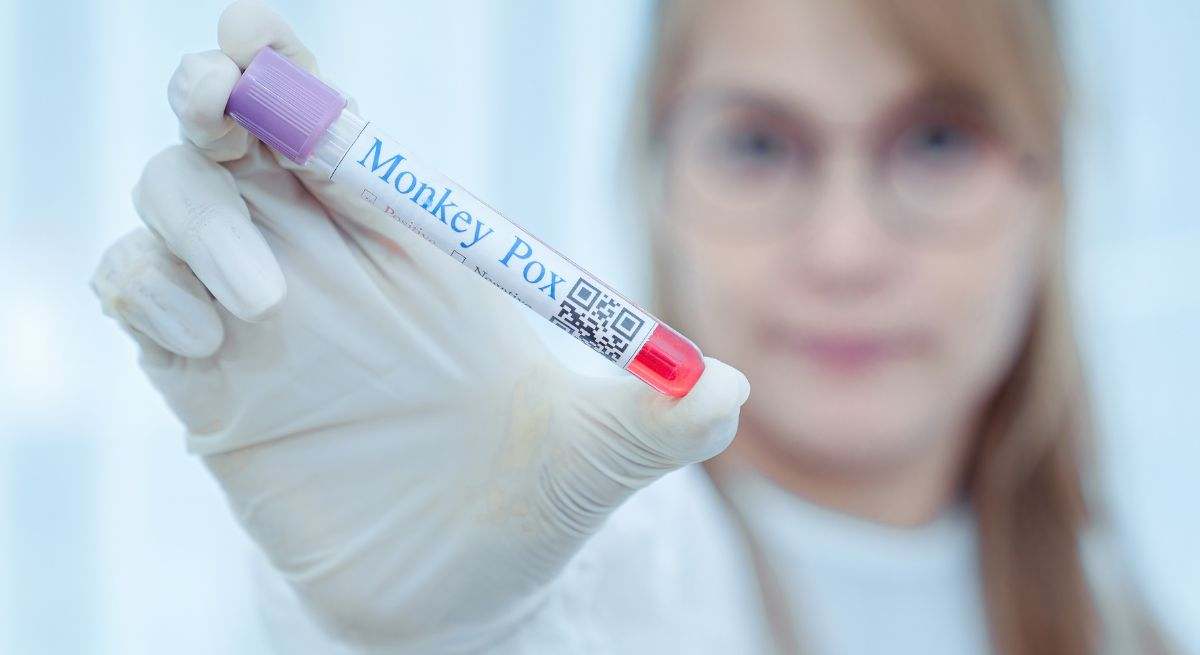 Es una enfermedad causada por el virus de la viruela símica