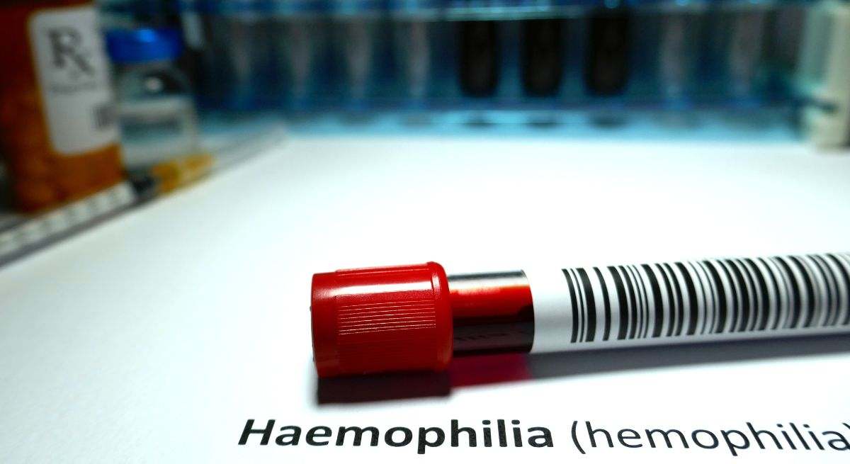 La hemofilia es una enfermedad hereditaria