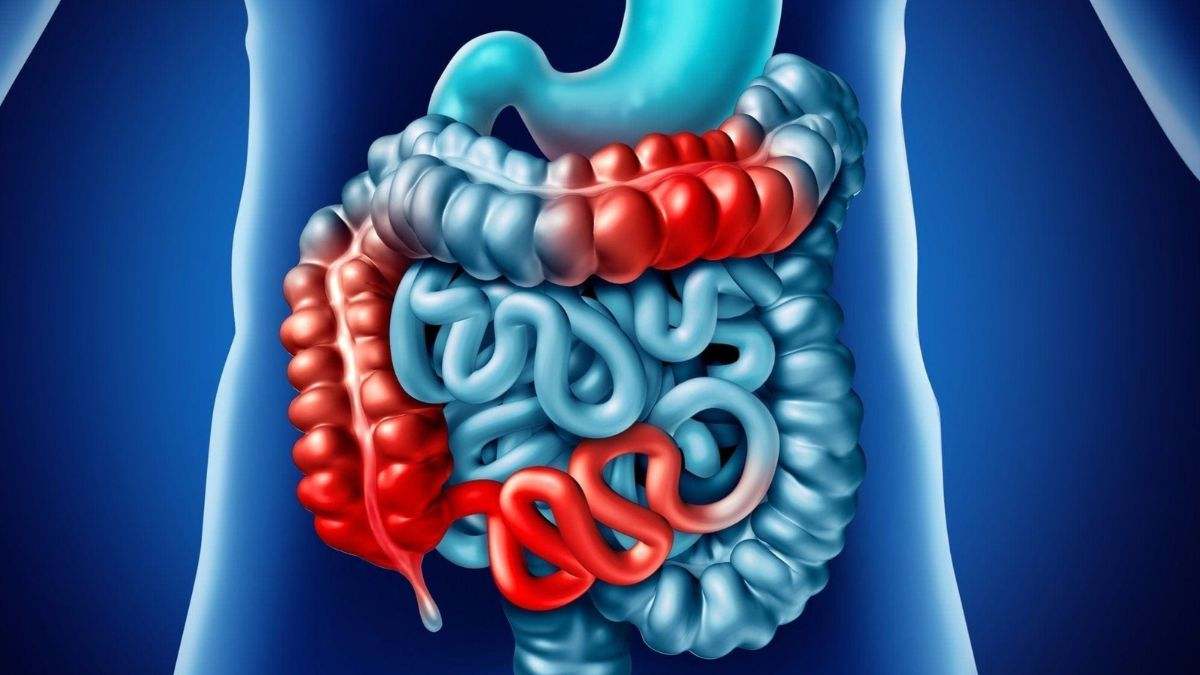 El intestino se considera el órgano inmunitario más importante del adulto