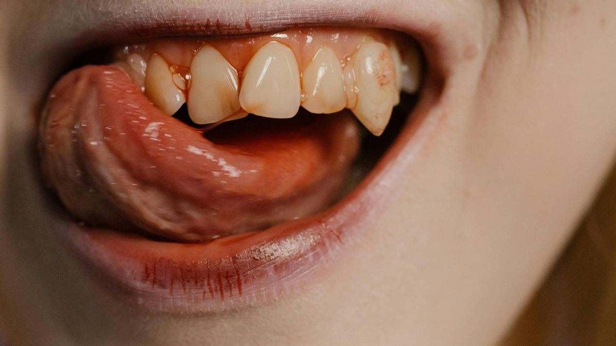 Una mujer se muerde la boca, de manera exagerada, mientras está comiendo