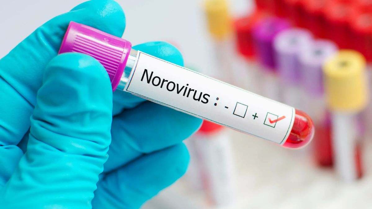 El norovirus es una enfermedad infecciosa y contagiosa