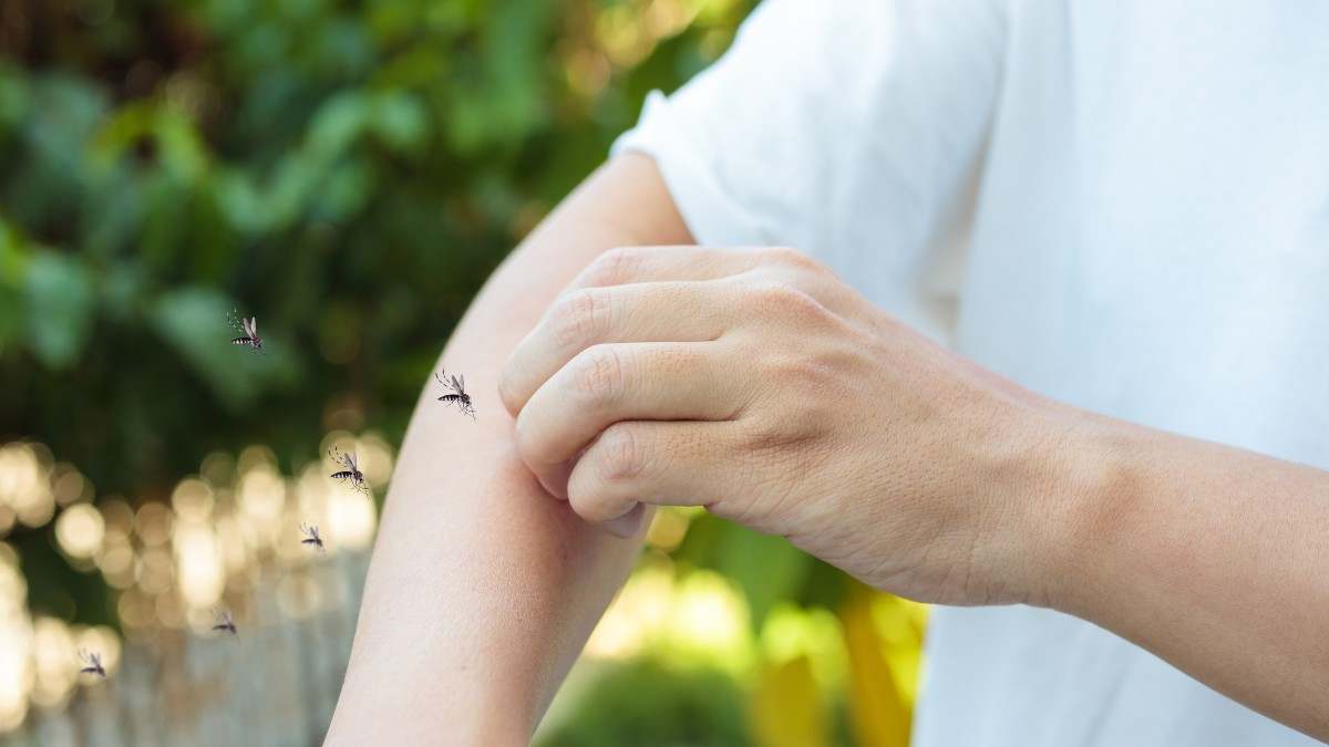 picazon-en-el-brazo-del-hombre-y-rascado-en-el-brazo-por-erupcion-cutanea-alergica-causada-por-la-picadura-de-mosquitos