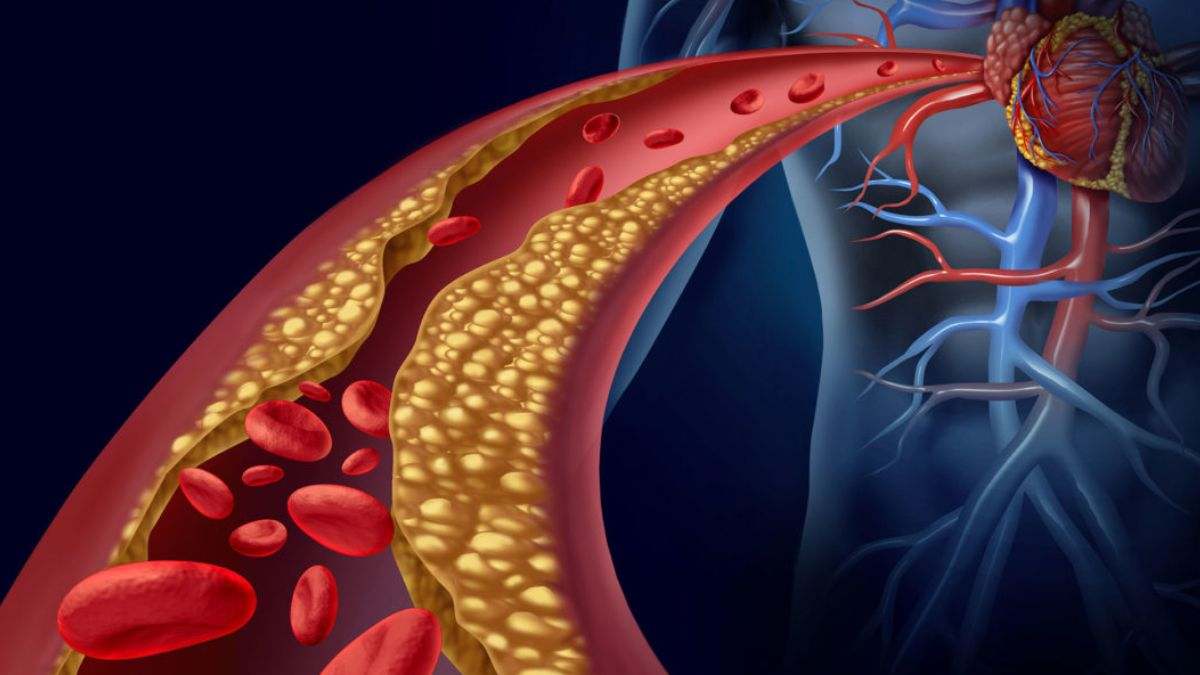 Tus niveles de colesterol son una medida importante de tu salud cardiaca