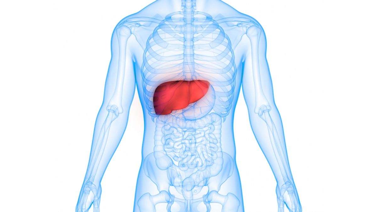 La hepatitis C es una infección viral que causa inflamación y daño al hígado