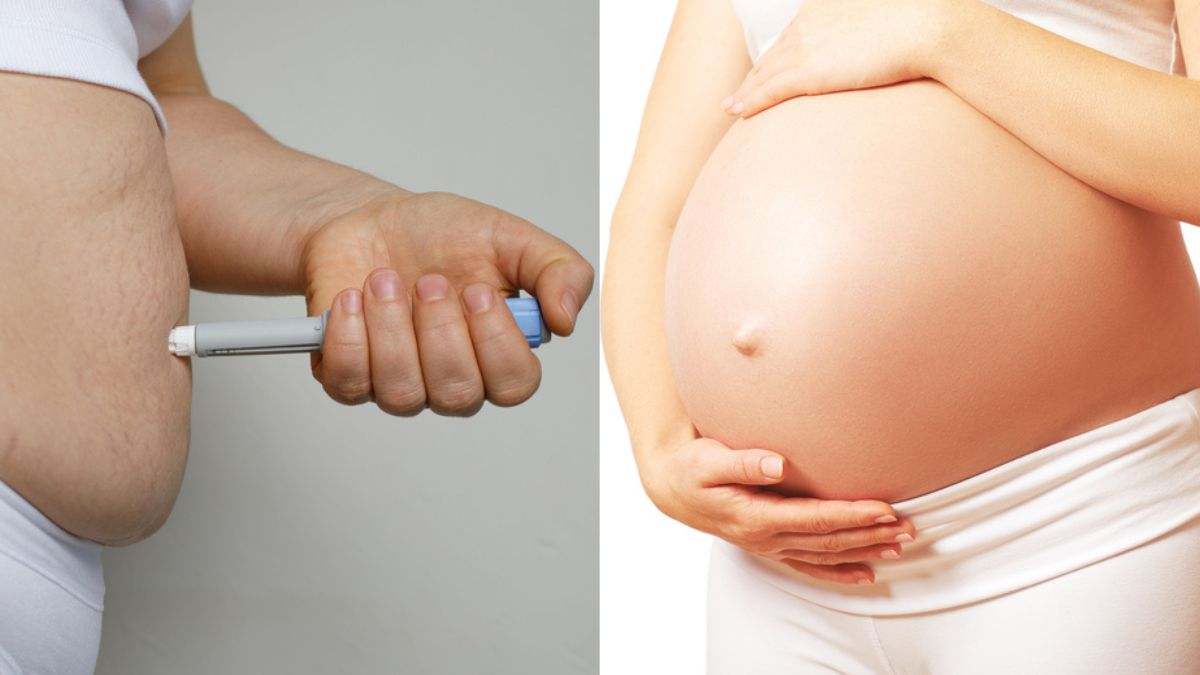 'Bebés Ozempic': ¿El fármaco contra la obesidad aumenta la probabilidad de embarazos inesperados?