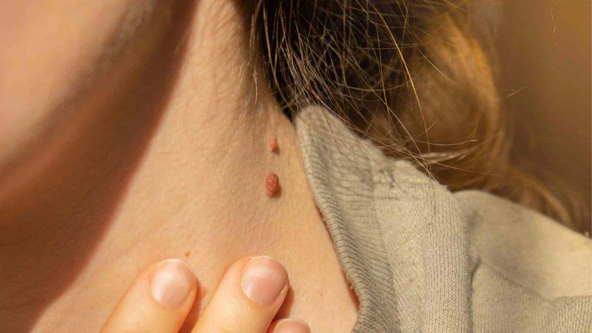Una mujer se toca una arruga que tiene en el cuello