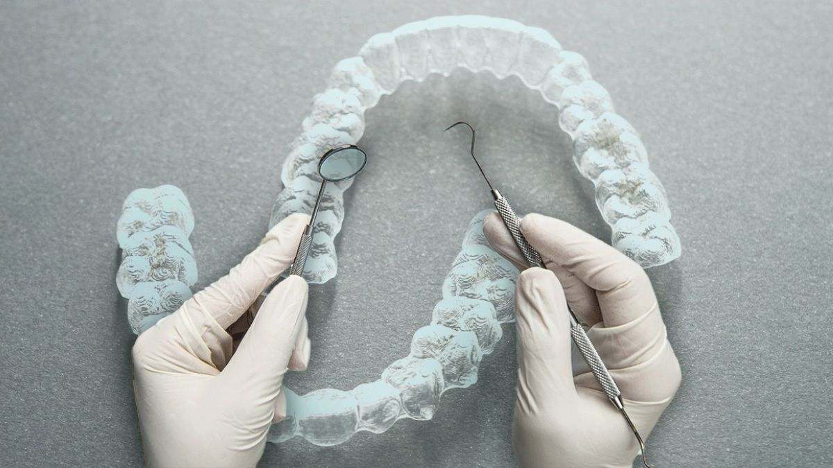 Caso Impress, aumentan las bajas de los alineadores invisibles: "Mejor detener el tratamiento y el pago ahora que perder mis dientes en un corto plazo"