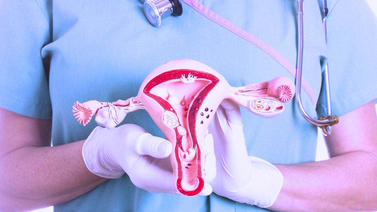 El factor de riesgo más importante del cáncer de cuello uterino es la infección por el virus del papiloma humano