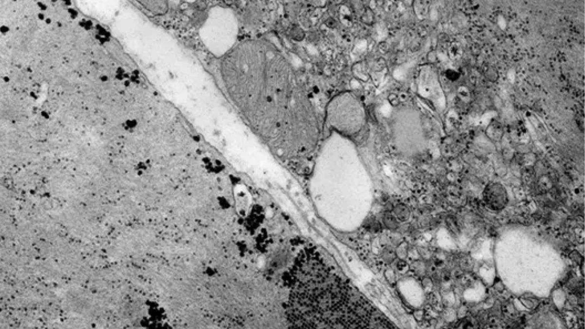 Documentan los primeros casos en España de un enterovirus raro ligado a enfermedad respiratoria y neurológica en menores