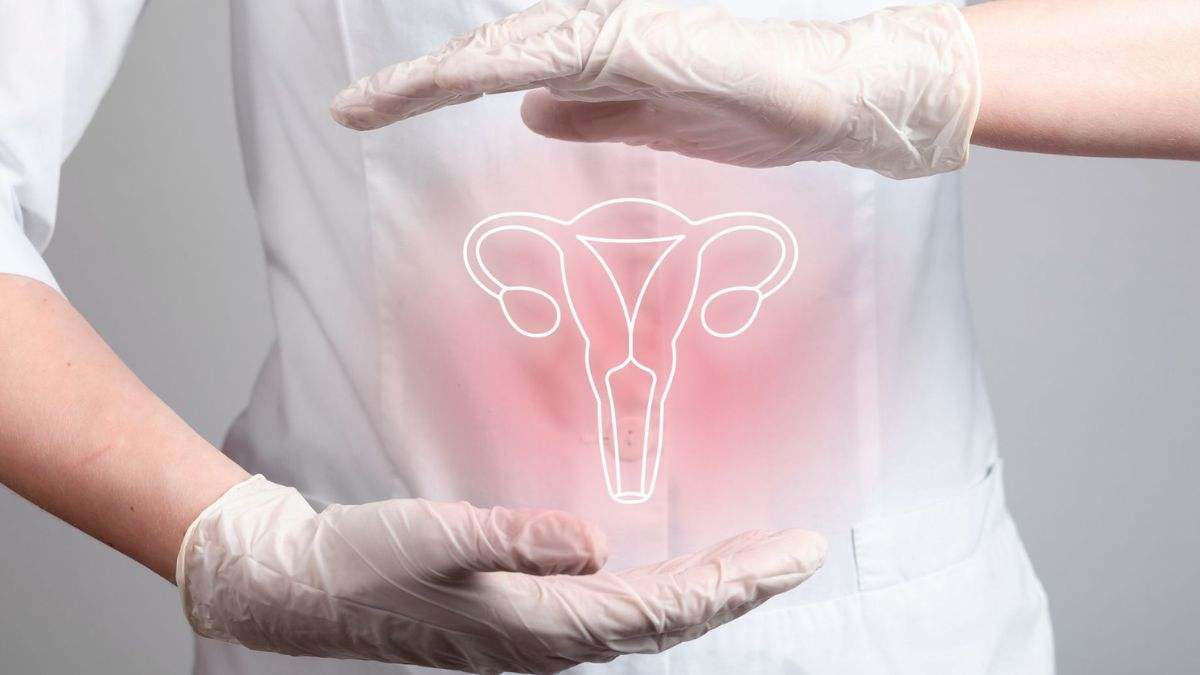 El cáncer de cuello uterino es cáncer que se origina en las células del cuello del útero