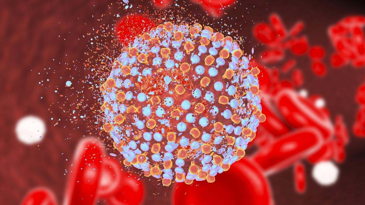 La hepatitis C (VHC) es un virus que causa inflamación del hígado