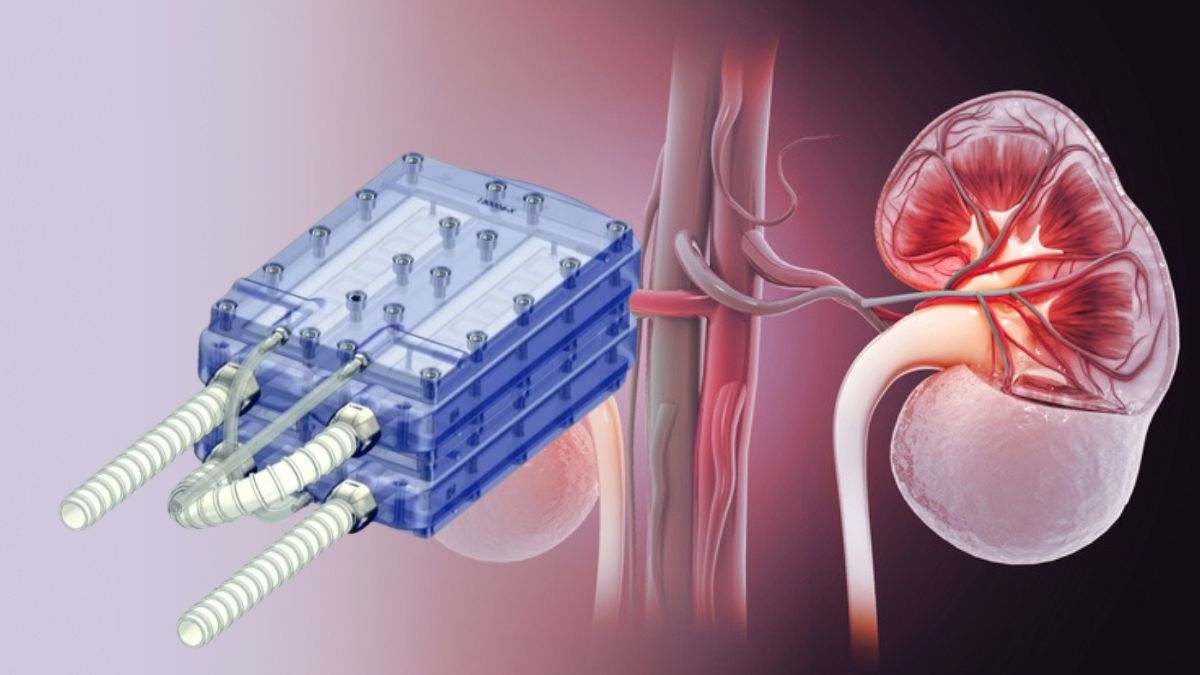 Así es el riñón bioartificial implantable para salvar millones de vidas: prototipo revolucionario que supera las pruebas preclínicas