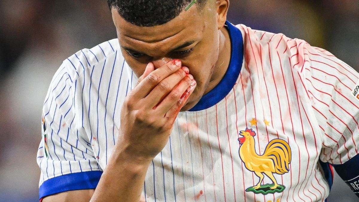 Mbappé sufre una fractura de nariz y todos se preguntan si abandona la Eurocopa: ¿Cuánto es el tiempo de recuperación de esta lesión?