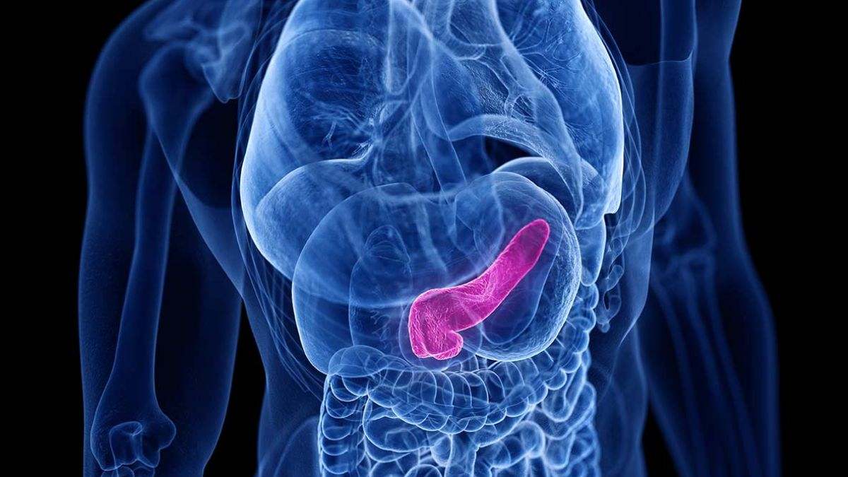 El cáncer de páncreas es un tipo de cáncer que se forma en los tejidos del páncreas