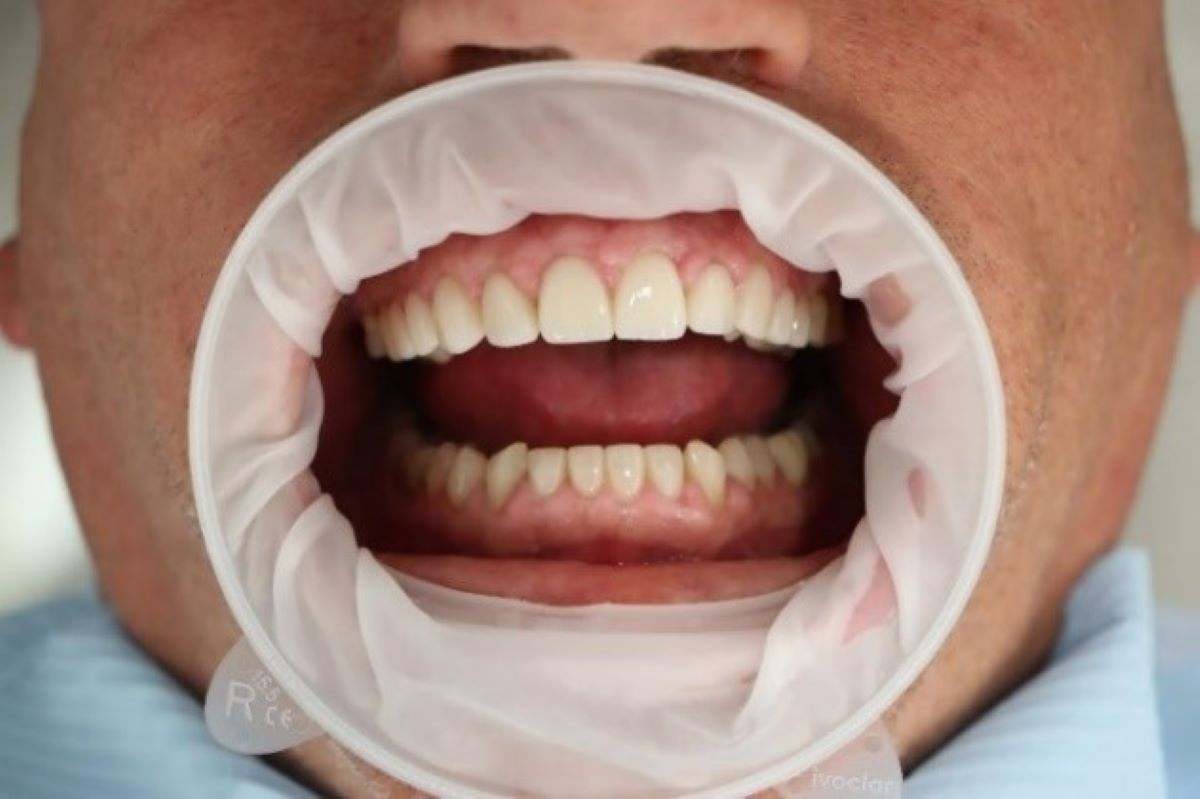estética dental