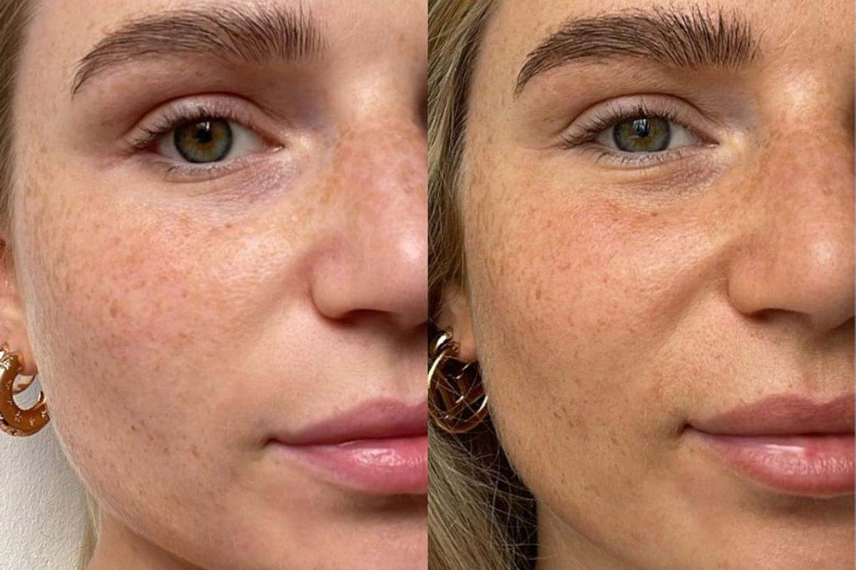 Las mejores gotas autobronceadoras con descuento