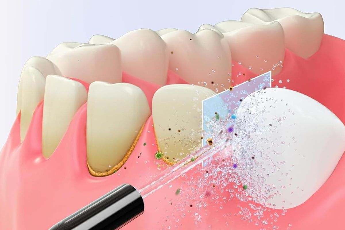El mejor irrigador dental con descuentazo2