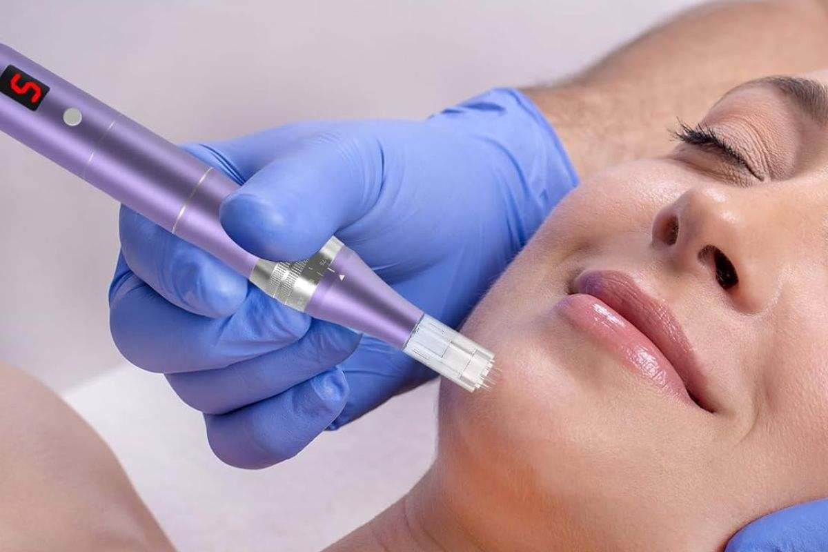 El mejor microneedling para la piel con descuento