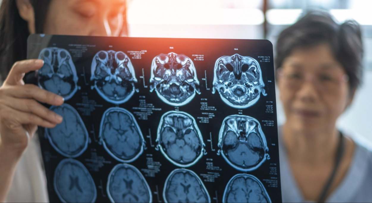 ¿Qué tipos de Alzheimer hay?¿Se conocen sus causas? Te lo contamos en este artículo.