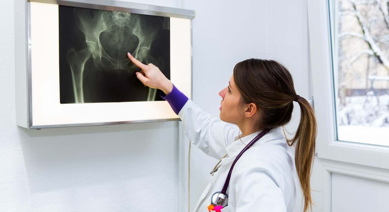 Una doctora observa una radiografía. / iStock