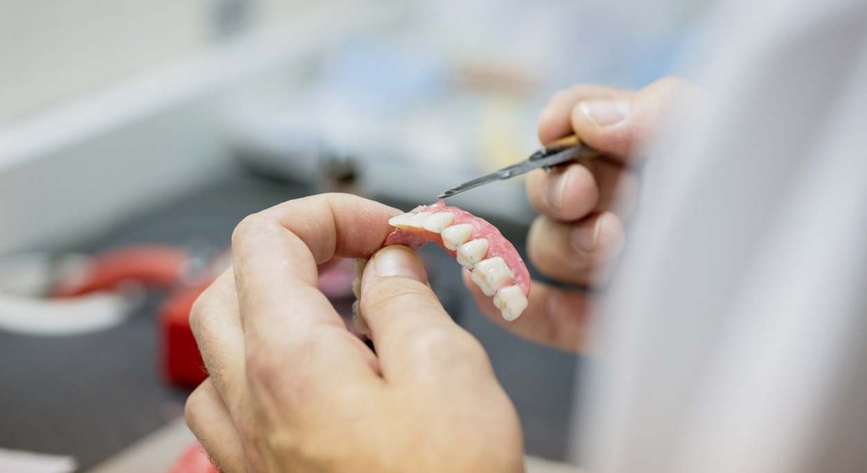Un dentista ajusta una prótesis dental