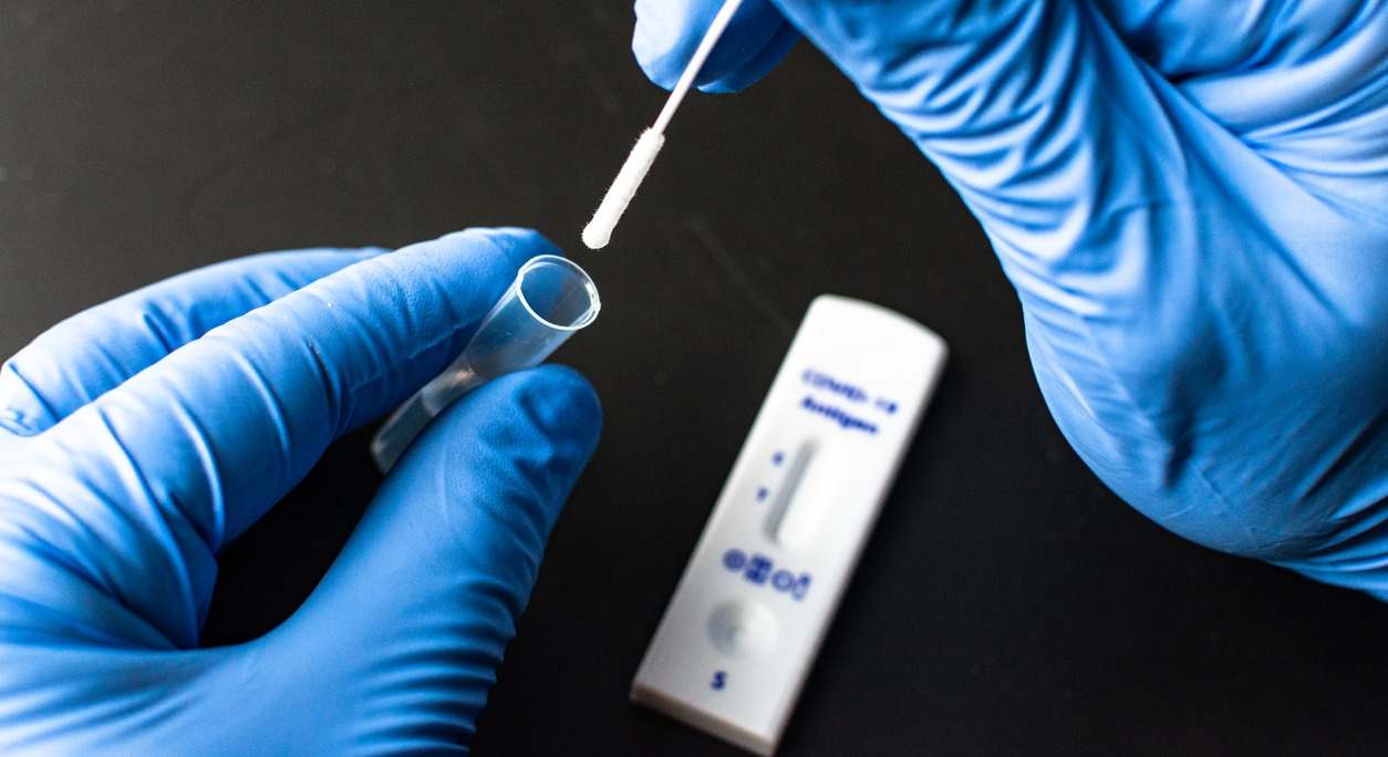 test de coronavirus