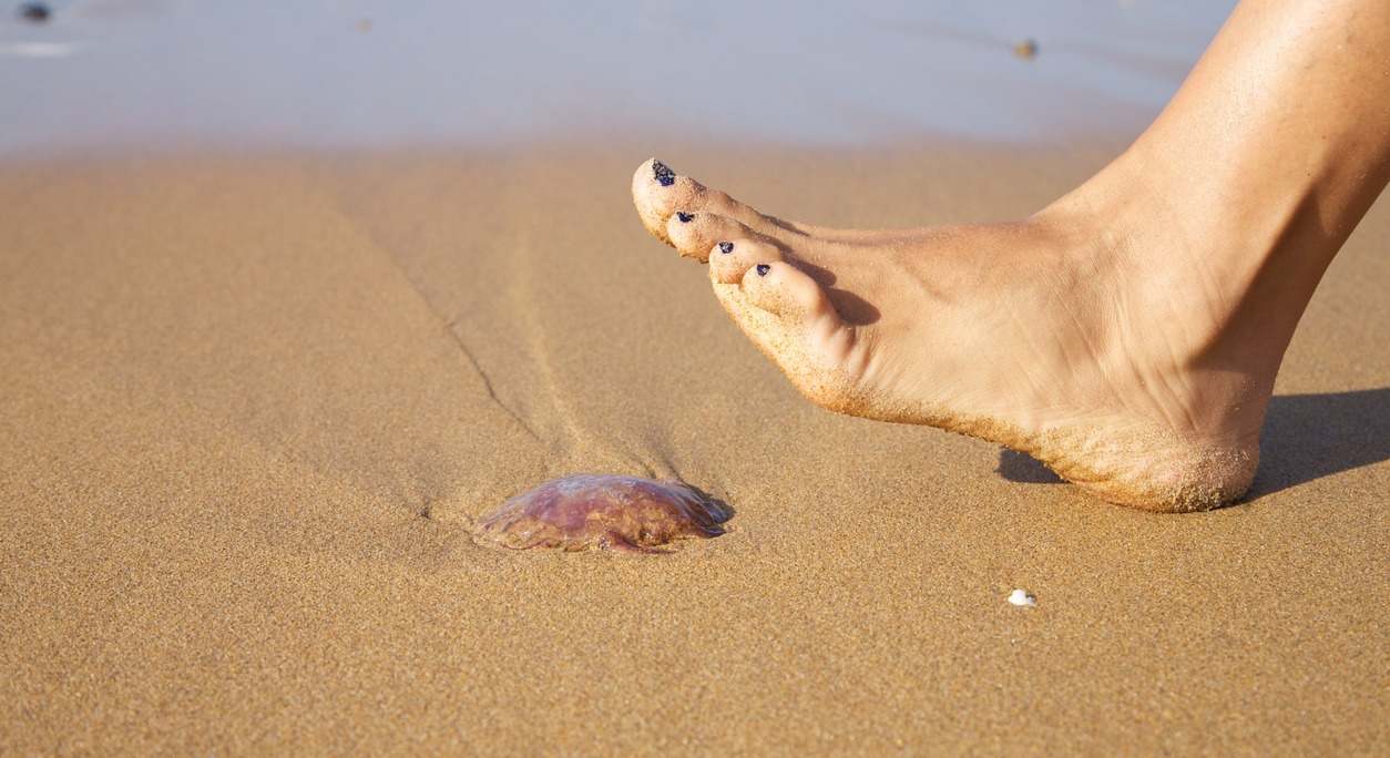 Las picaduras de medusa con las picaduras más comunes en el mar. Descubre en este artículo como aliviar el dolor.