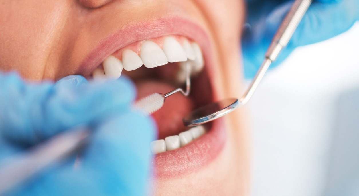 Revisión de la salud bucodental. / Foto: iStock