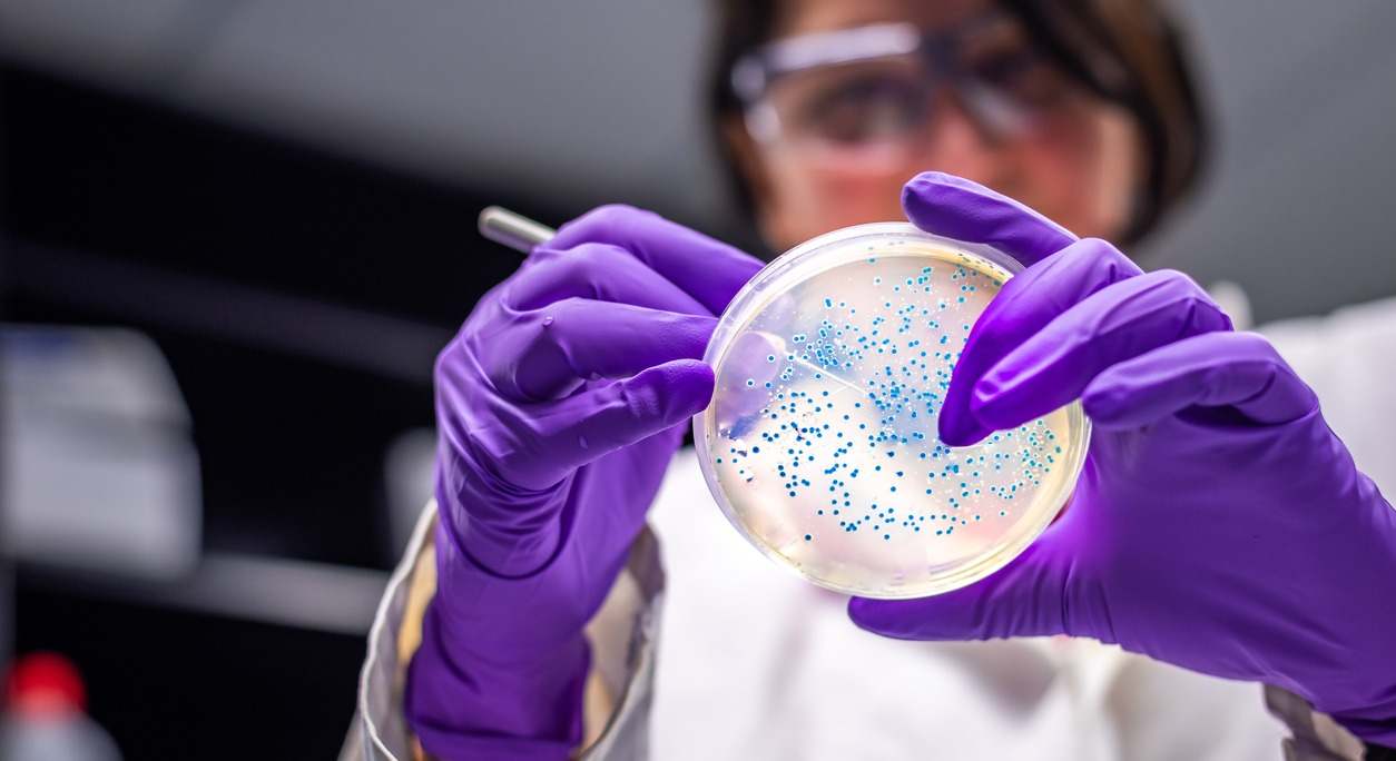 ¿Que es la bacteria E.coli y como puede afectarnos? Te lo contamos en el siguiente artículo