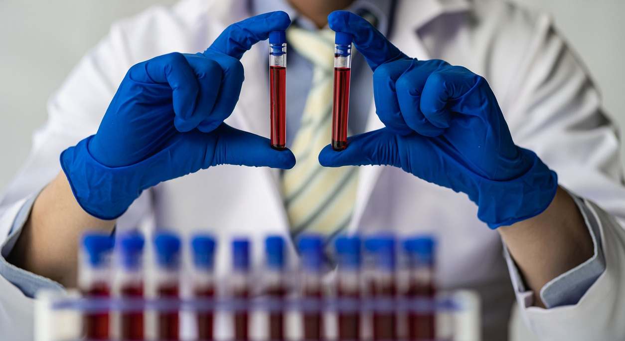 En este artículo encontrarás información relevante sobre los cánceres de sangre, como los tipos que existe y sus síntomas.