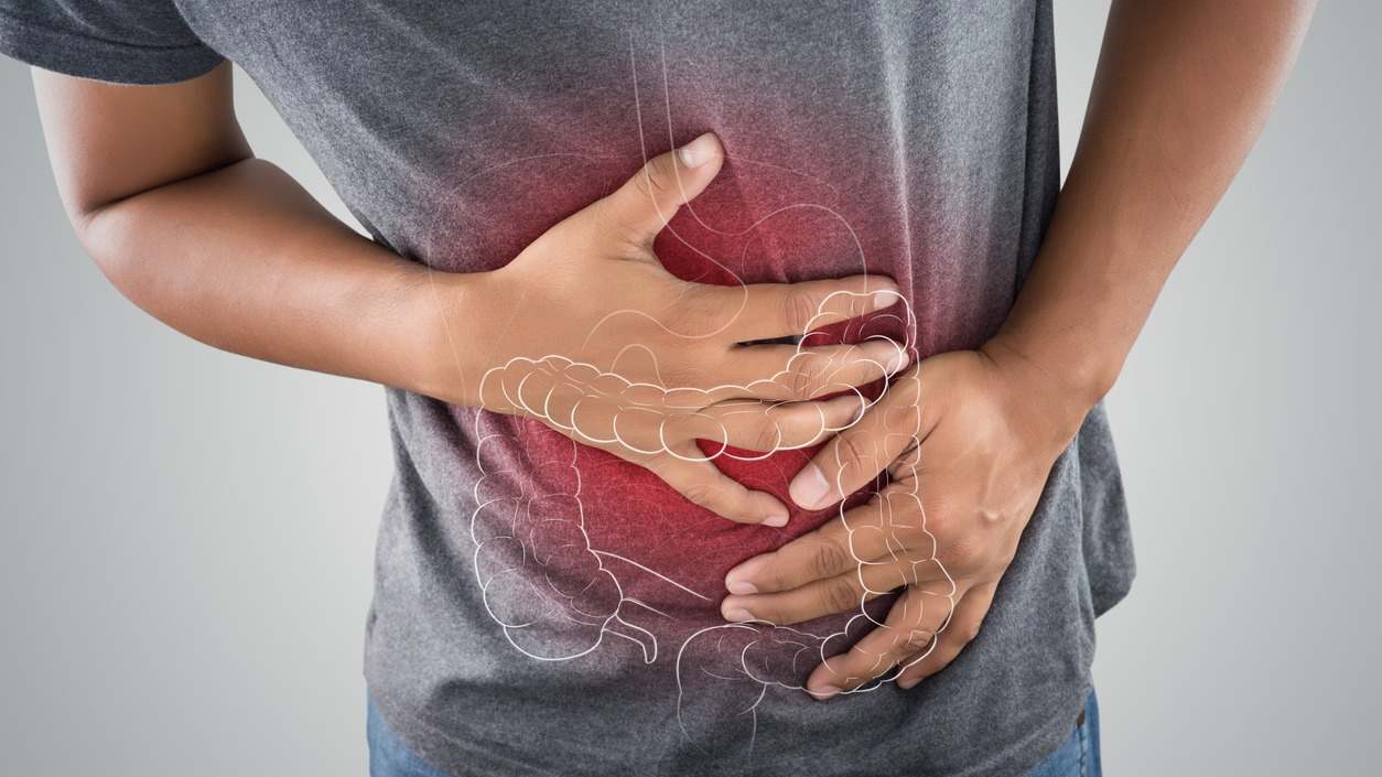 La colitis ulcerosa es una enfermedad inflamatoria del intestino grueso (colon). En este artículo te contamos sus causas y tratamiento