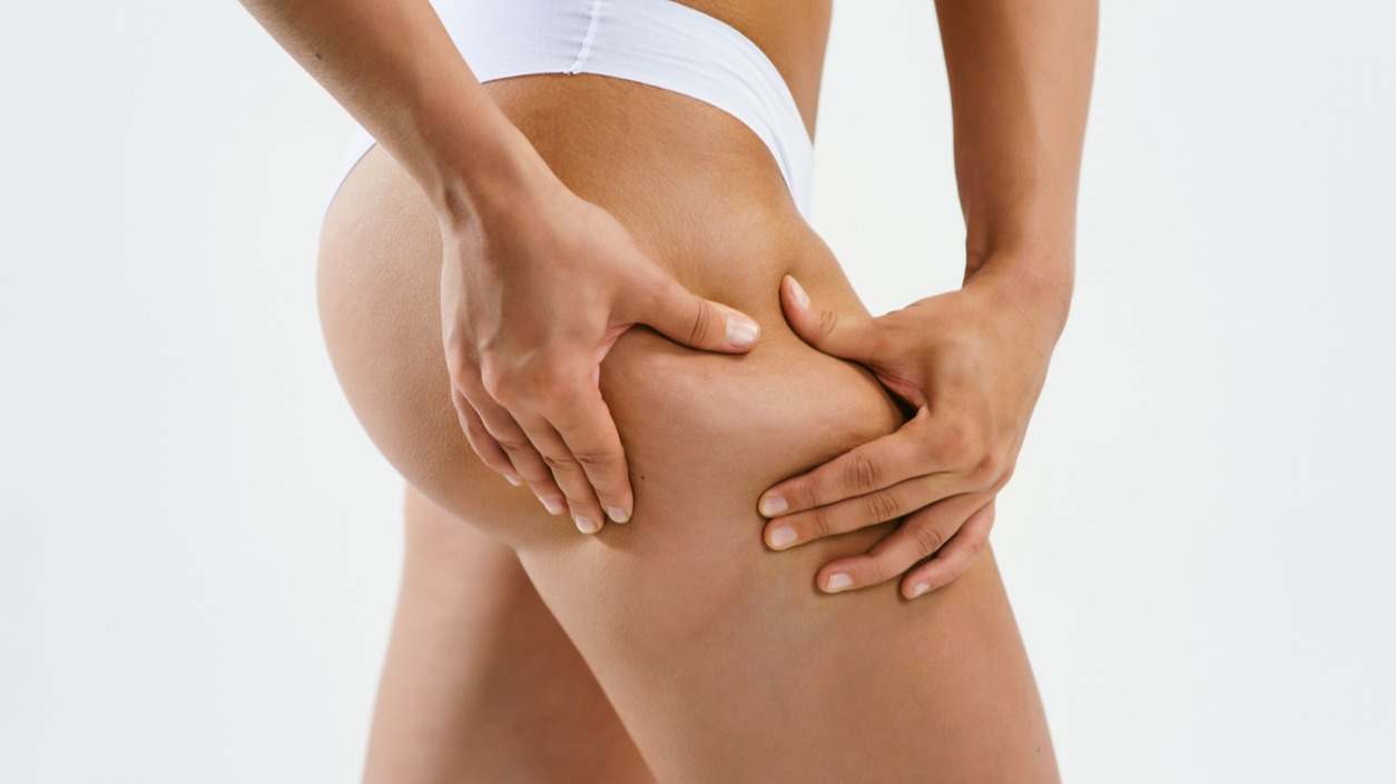Cómo eliminar la celulitis: tipos y consejos para hacerle frente