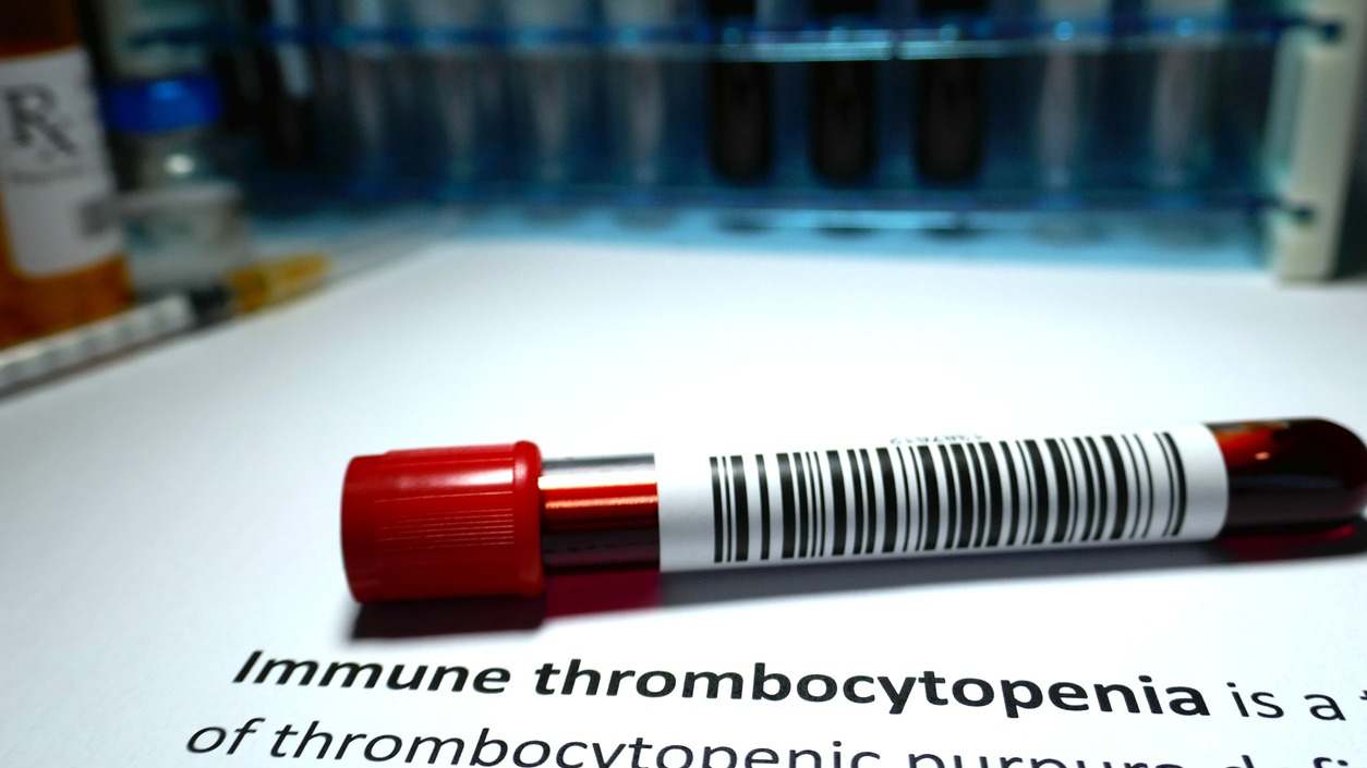 Descubre la Trombocitopenia Inmune Primaria (PTI): sus causas, síntomas y opciones de tratamiento. Conoce cuándo es crucial consultar a un médico ante signos como sangrado inexplicado, equimosis, fatiga persistente y más. Obtén información clave para comp
