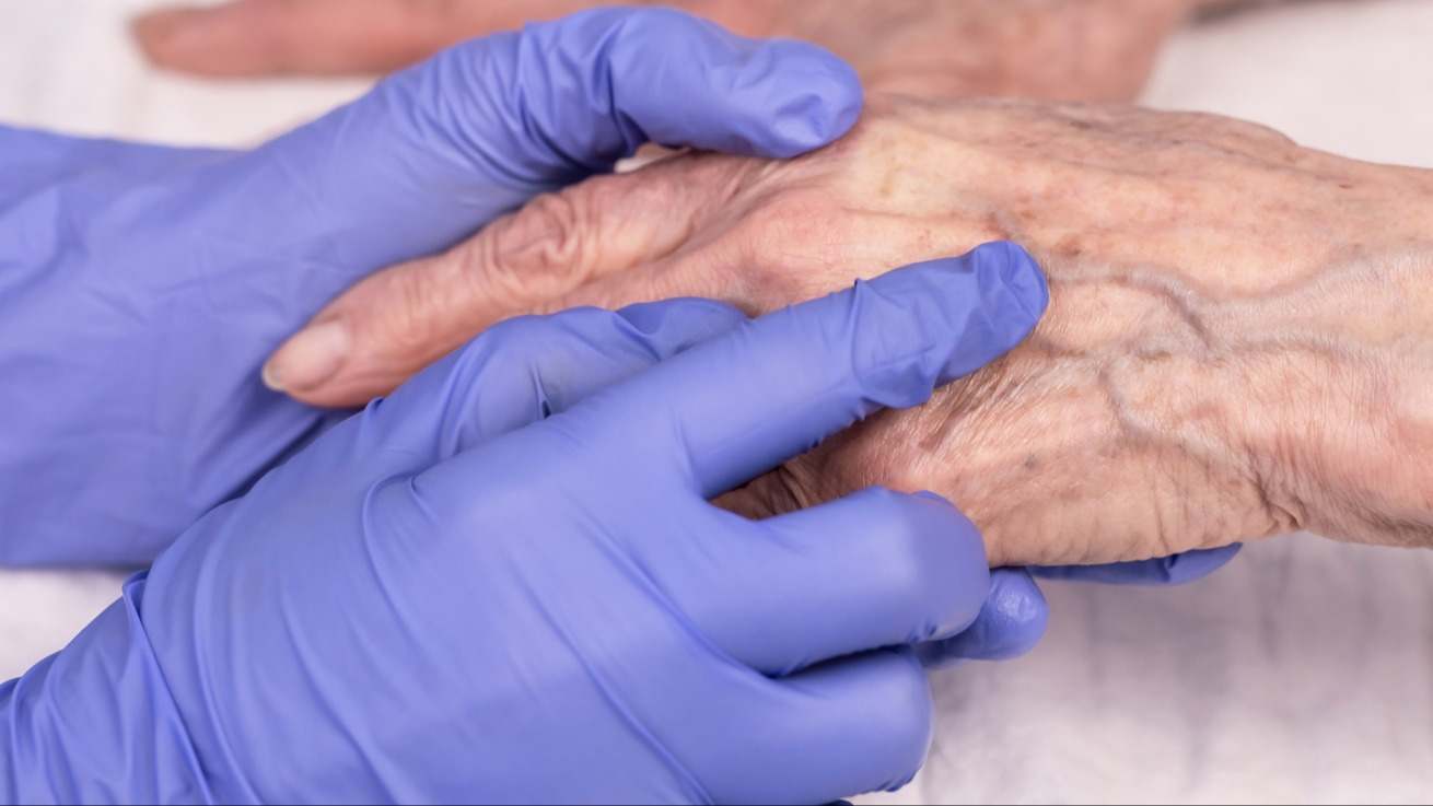 Explicamos en detalle qué es la esclerodermia, cómo identificarla, qué síntomas tiene, sus posibles causas y los tratamientos existentes.