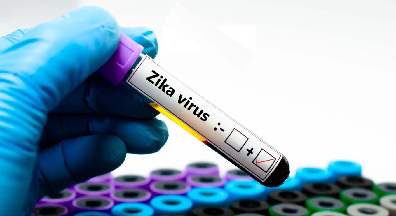 ¿Cuál es la incidencia del virus Zika en España? ¿Cómo se propaga? ¿Cuáles son sus síntomas? ¿Y su tratamiento? Respondemos a todas estas pregunta.