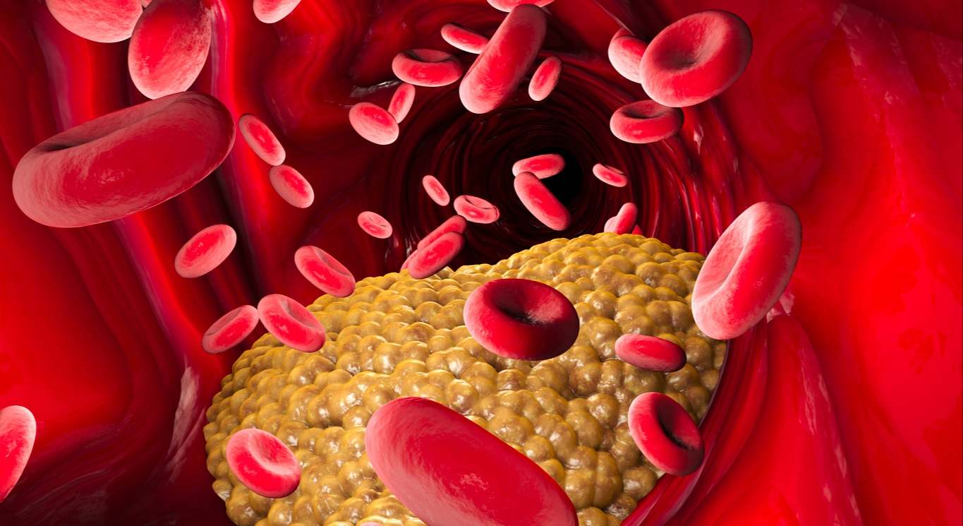 Los triglicéridos son el tipo de grasa más común en nuestro cuerpo. Descubre en este artículo que son y como bajar sus niveles en sangre.