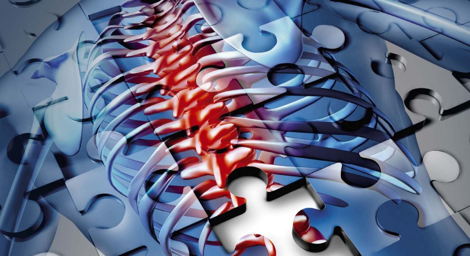 Estenosis de canal lumbar
